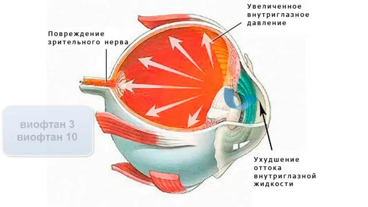 Лечение глазного нерва. Атрофия зрительного нерва. Повреждение глазного нерва. Атрофия диска зрительного нерва. Атрофия глазного нерва.