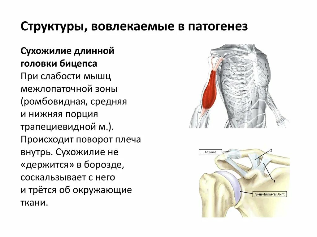 Сухожилие длинной головки бицепса. Плече-лопаточная периартрит. Длинная головка двуглавой мышцы плеча. Длинная и короткая головка бицепса.