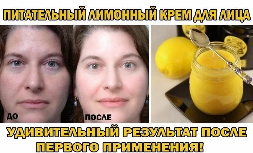 Лимон от пигментных пятен на лице. Масло лимона от пигментных пятен. лимонный сок для лица. лимон для лица отбеливание. крем с лимоном для лица.