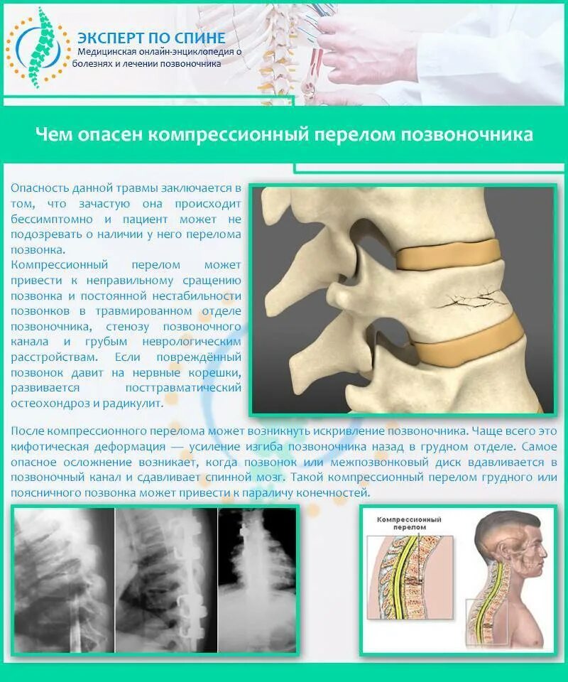 Перелом позвоночника у ребенка последствия. Компрессионный перелом тела позвонка т 5. Компрессионный перелом позвоночника th11. Компрессионный перелом д6 позвонка неврологические. Позвонок l1 компрессионный перелом у ребенка.