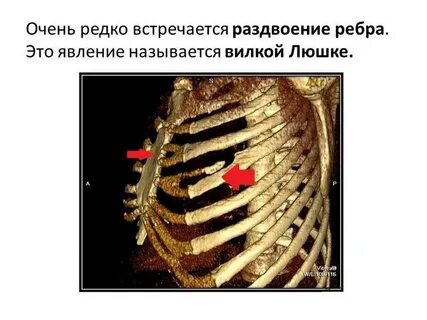 Ребро люшке
