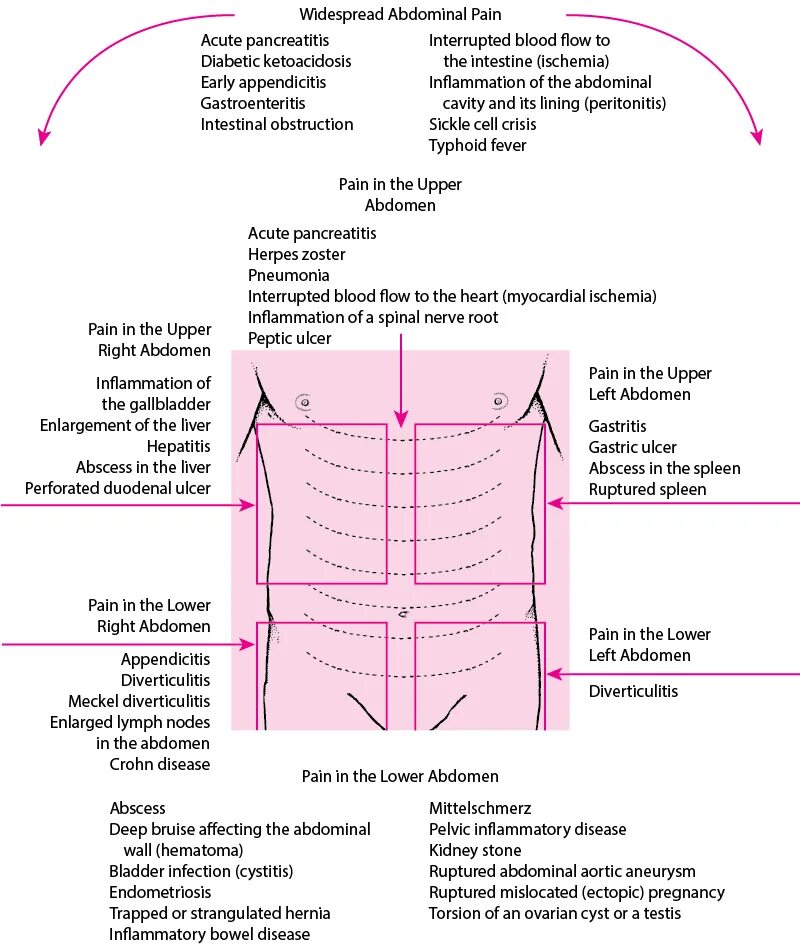 Живот болит текст. Acute abdominal Pain. Pain in the abdomen. Боли в области живота. Боли в области живота и таза.