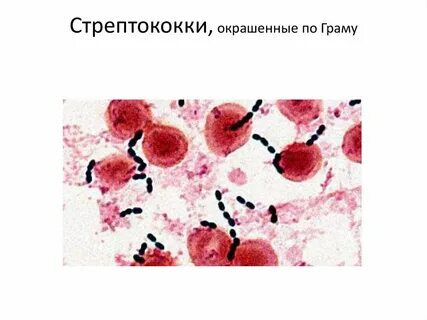 Виды стрептококков в мазке