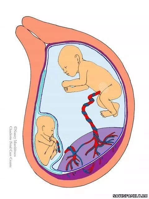 дети и родители вместе. уложить ребенка спать. кормление грудью двоих детей. рождение ребенка пуповина. чем занять детей дома.