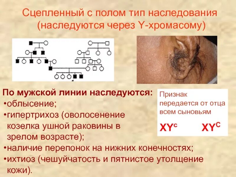 Гипертрихоз передается через y хромосому