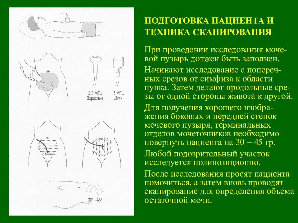 Остаток мочи у мужчин. УЗИ остаточной мочи у женщин. Норма остаточной мочи. УЗИ мочевого пузыря объем остаточной мочи. УЗИ объем остаточной мочи в норме.