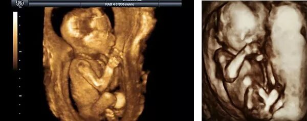 расскажи мне сказку постер. Visual journal 500. пол уэсли 2021. узи на 16 неделе беременности пол ребенка. Paul weeks.