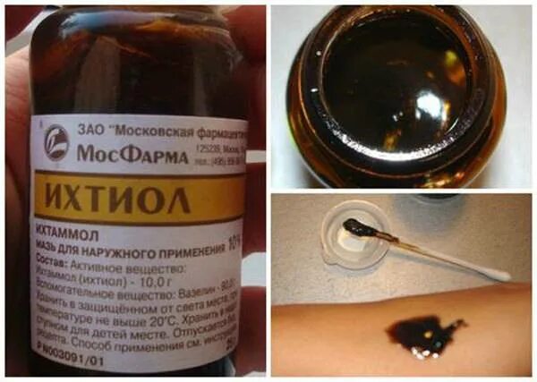 Ихтиоловая кожа. Ихтиоловая мазь 20%. вытягивающая мазь ихтиол. ихтиоловая мазь от прыщей.