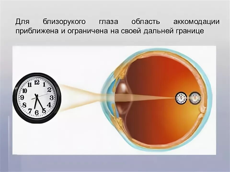 Презентация глаз как оптическая система 9 класс