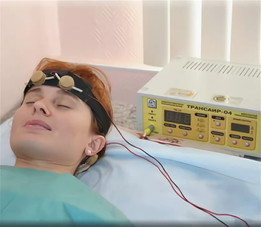 Электросон трансаир. Транскраниальная импульсная электротерапия. Тэс терапия трансаир. Тэс физиотерапия. Тэс транскраниальная.