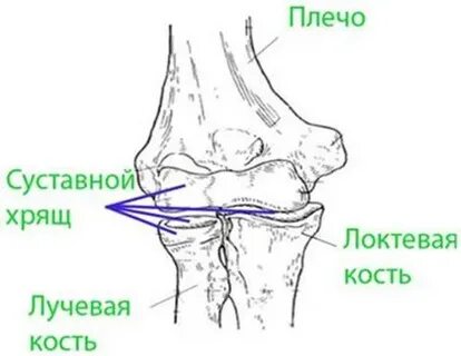 Мкб 10 ушиб локтевого сустава