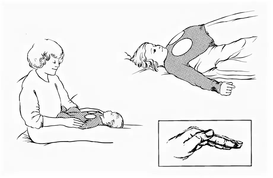 Постуральный массаж. Дренажный массаж ребенку для отхождения мокроты. Постуральный массаж для отхождения мокроты детям. Массаж для отхождения мокроты у ребенка 1 год. Дренажный массаж младенцу для отхождения мокроты.
