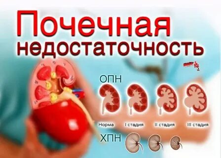 Нмо ответы хроническая болезнь почек у детей