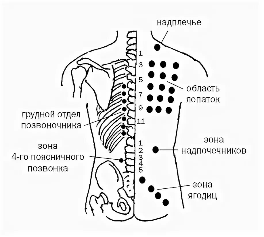 Паравертебральные зоны схема. Паравертебральные точки грудного отдела позвоночника. Грудной отдел позвоночника паровертебральнвн точки. Паравертебральные зоны спины.