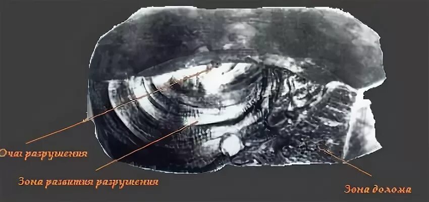 Понятие усталостного разрушения зоны. Схема усталостного излома. Усталостный вязкий излом. Зоны усталостного излома. Хрупкий вязкий усталостный излом металла.