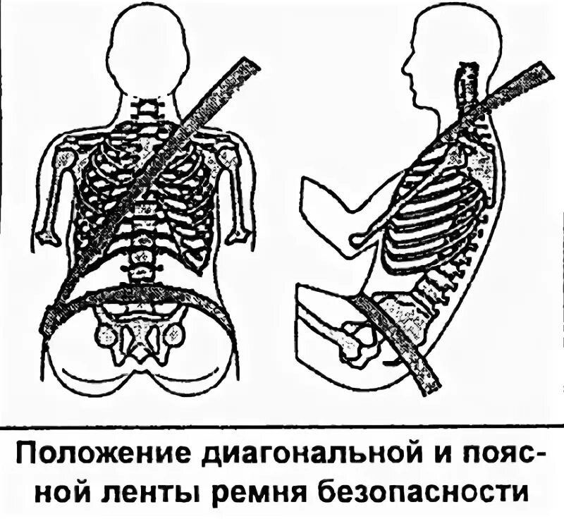 Приседания нога сзади. Перекрестно диагональный способ движения агрегата. Диагональное положение. Диагональное положение. Положение пациента в кровати.