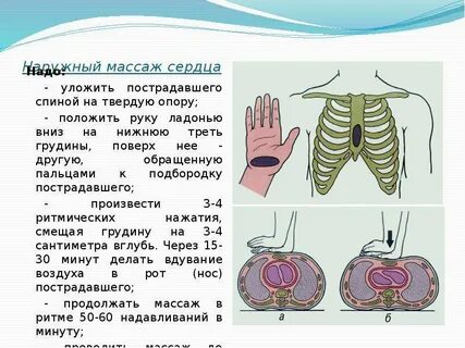 Граница средней и нижней трети грудины