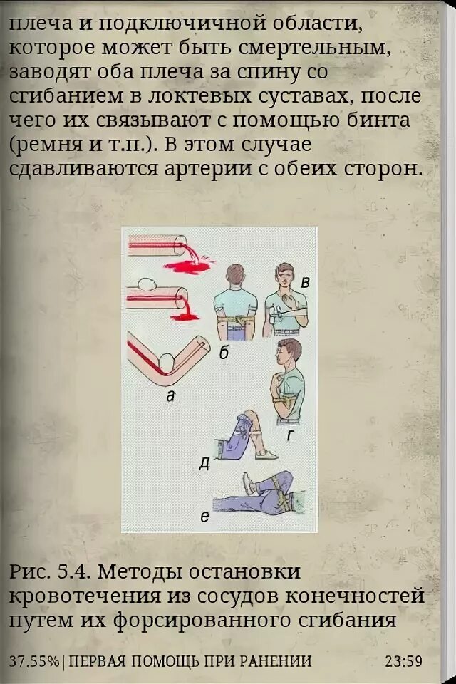 Первая помощь при падении. Оказание первой помощи при ранениях и кровотечениях. Дизентерия первая помощь доврачебная. Доврачебная помощь при ложном крупе. Тест 1 медицинская помощь