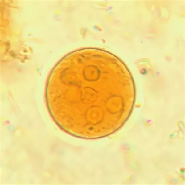 Цисты Entamoeba. Entamoeba coli циста. Цисты лямблии микроскопия. Entamoeba histolytica циста в Кале. Entamoeba coli в кале