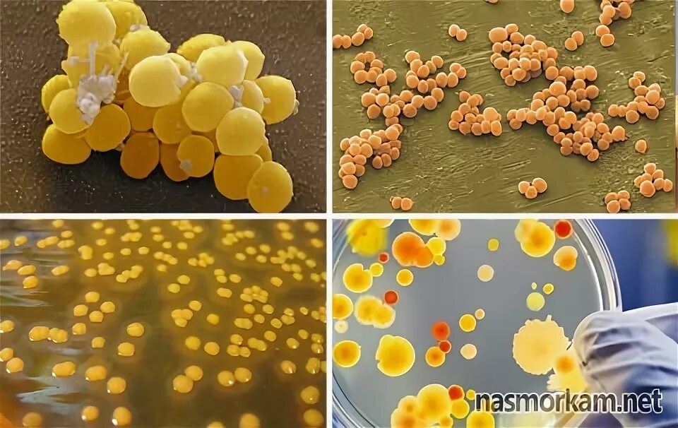 Staphylococcus aureus в носу. Золотистый стафилококк выглядит. Высеянный золотистый стафилококк. Золотистый стафилококк у малыша.