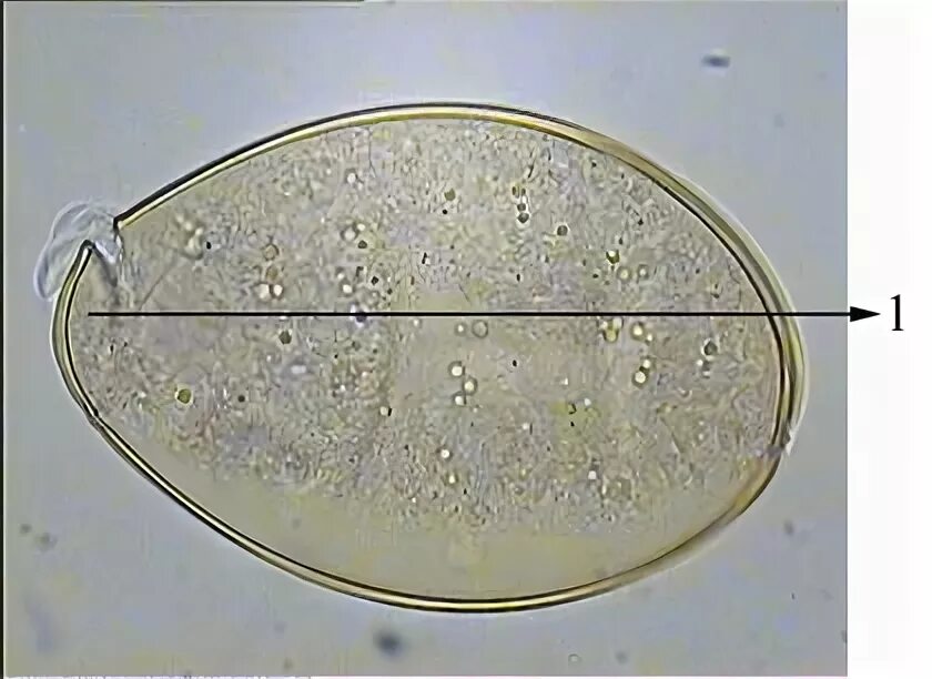 Яйца широкого лентеца. Широкий лентец яйца микроскоп. Строение яйца лентеца. Дифиллоботриум Латум яйца. Яйцо с онкосферой