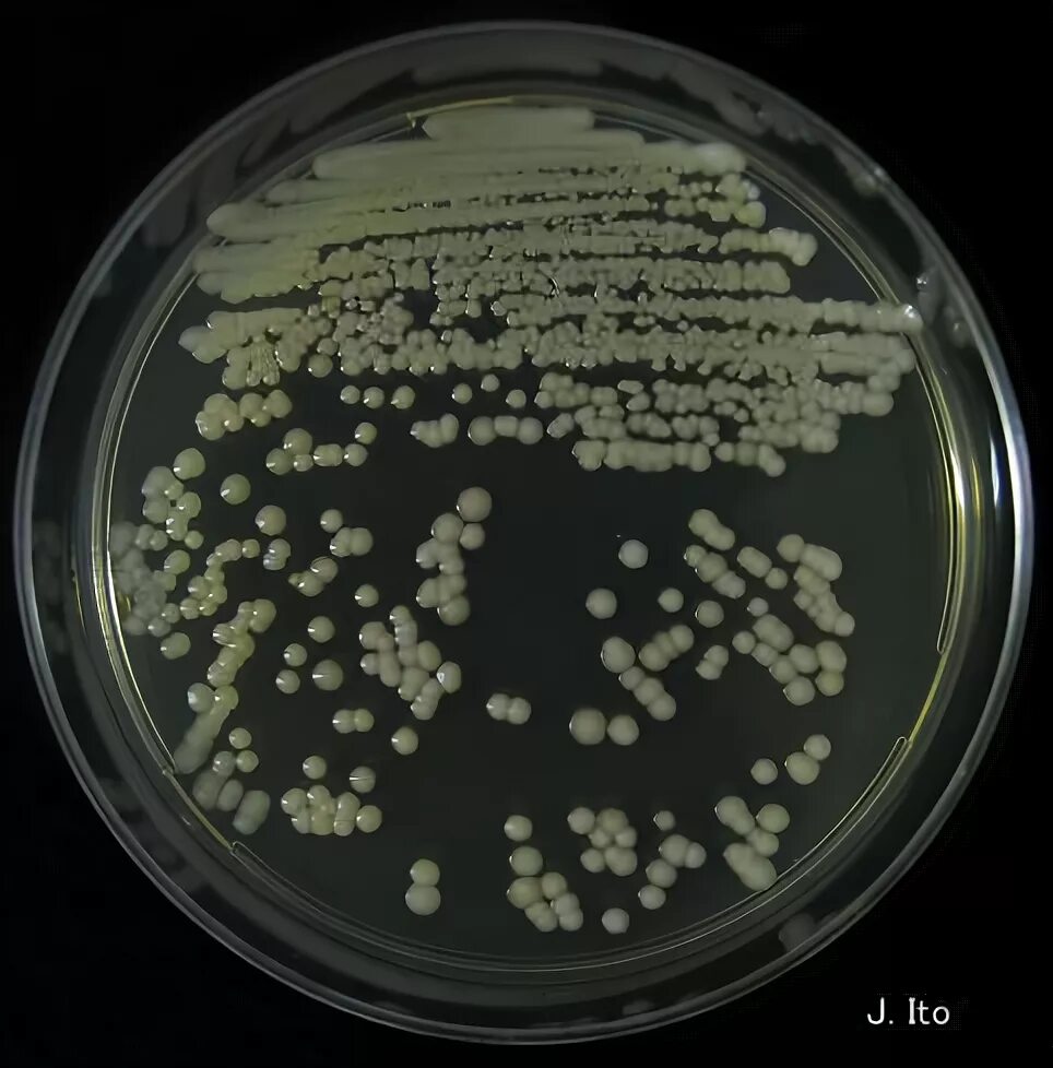 Candida капсула. Кандида на агаре Сабуро. Candida albicans колонии на Сабуро. Candida tropicalis на среде Сабуро. Кандида альбиканс под микроскопом.