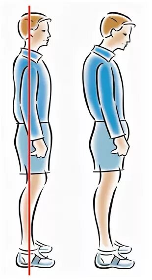 Плохая осанка портящая красоту жениха сканворд. Правильная осанка. Осанка в положении стоя. Биомеханика в положении стоя. Правильная осанка в положении стоя.