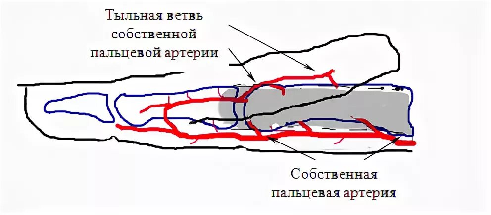 Перекрестная пластика пальцев кисти. Перекрестная кожная пластика. Реплантация пальцев кисти. Повреждение мелких артерий кистей и стоп