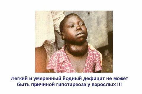 Гипотиреоз загорать