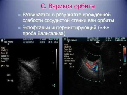 Сосудистый режим