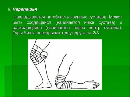 Черепашья повязка