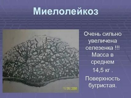 Масса селезенки