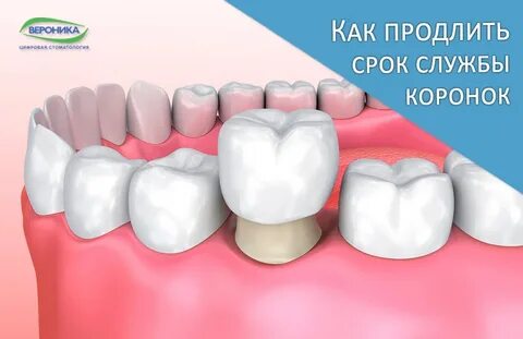 Коронка срок гарантии