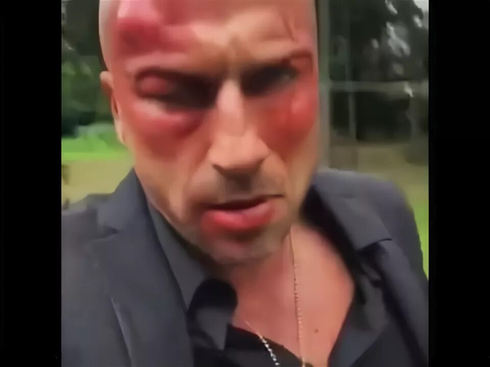 Нагиева избил бывший. Нагиева избил бывший