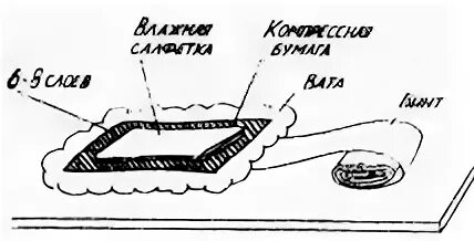Слои согревающего компресса