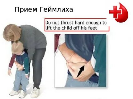 Прием геймлиха детям старше года