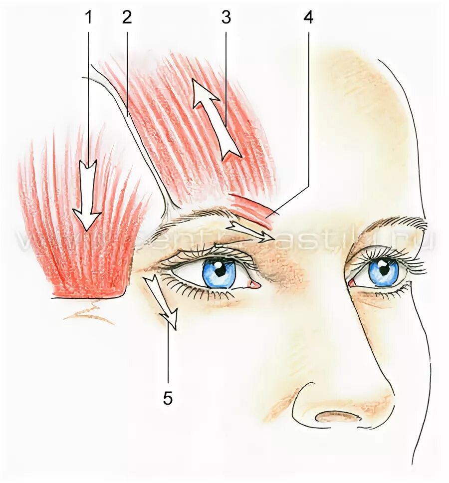 Колет бровь. Мышца поднимающая бровь. Точки ботокса для поднятия бровей. Точки введения ботулотоксина для поднятия брови. Ботокс схемы для поднятия бровей.