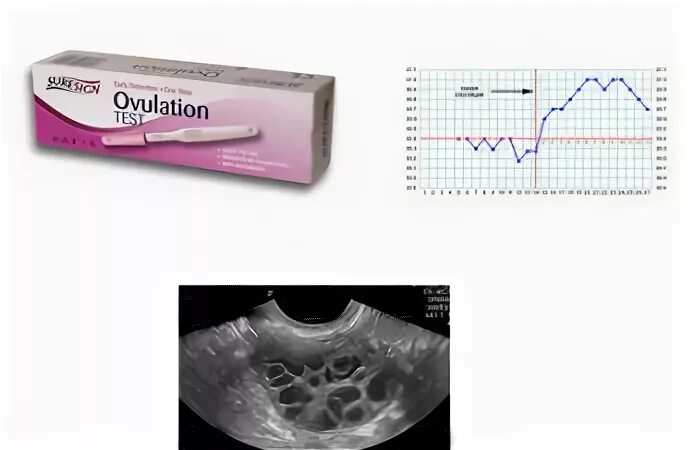 Признаки овуляции ощущения выделения. Овуляция ощущения.