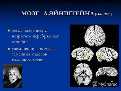 Церебральная атрофия 1