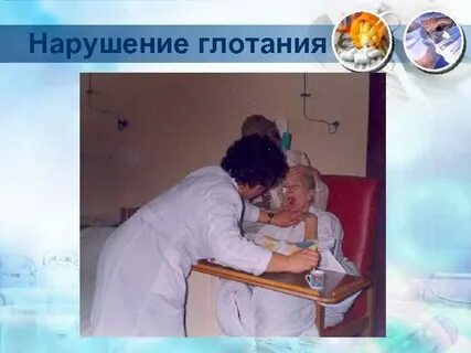 Рефлексы после инсульта