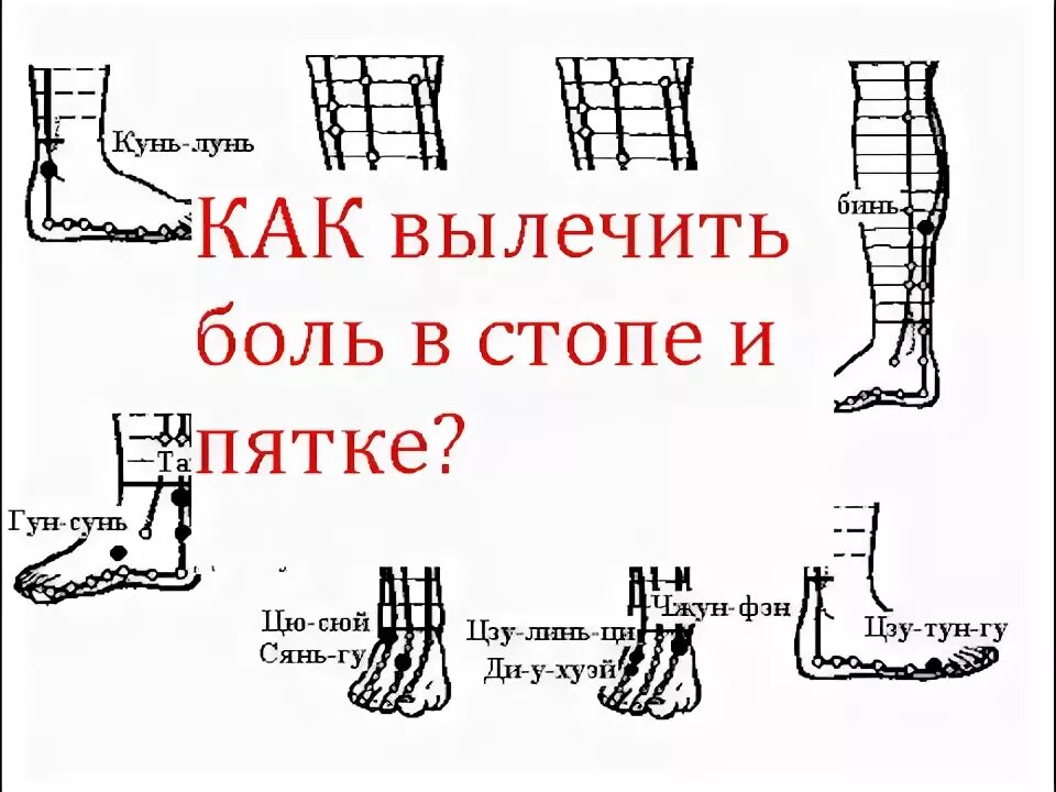 Как вылечить боль в стопе и пятке? - YouTube
