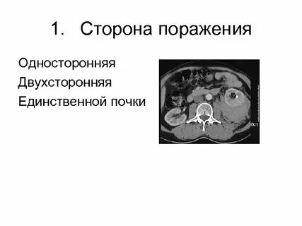 Одностороннее поражение