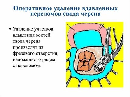 Оперативного устранения