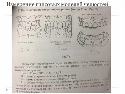 Улыбка анализы