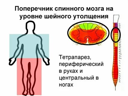 Уровни спинного мозга