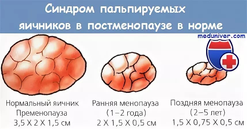 Размер яичников норма таблица Придатки размеры норма