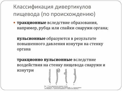 Классификация пищевода