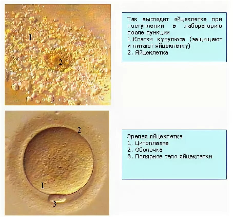 Яйцеклетки сохраняют способность к оплодотворению. Яйцеклетки после пункции. Яйцеклетка эко. Извлечение яйцеклетки для эко. Оплодотворение яйцеклетки при эко.