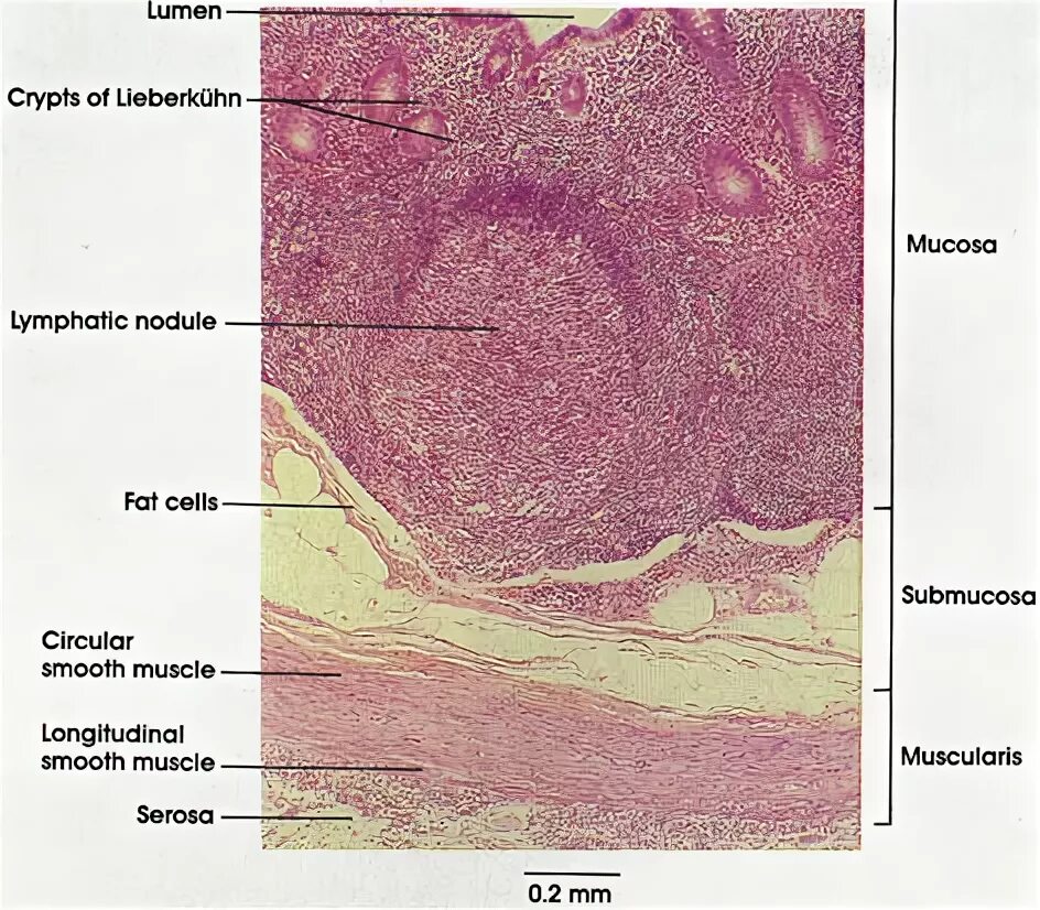 Строение стенки аппендикса гистология. Аппендикс гистология препарат. Червеобразный отросток гистология препарат описание. Строение аппендикса гистология.