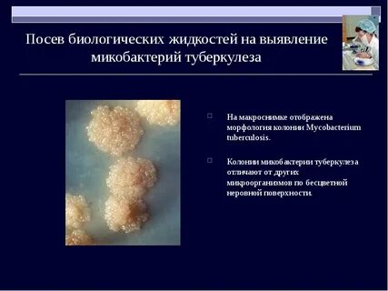 Среда для микобактерий туберкулеза